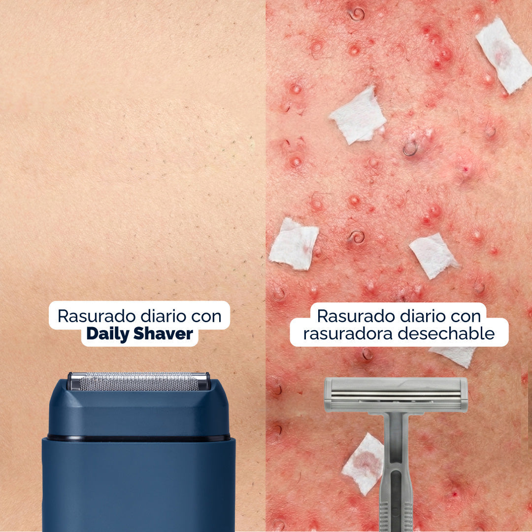 ✨  NUEVA Daily Shaver® – Rasuradora Facial MyHUEVOS®